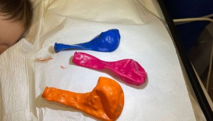 Antep'te 1 yaşındaki bebeğin midesinden 3 balon çıkarıldı!